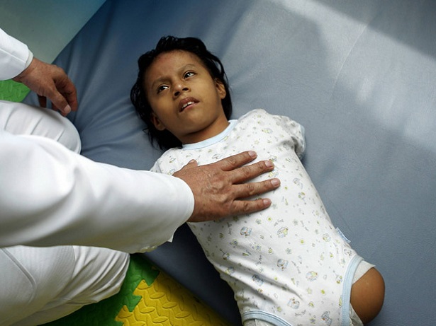 Yovana presta atenção ao médico durante a terapia (Foto: Reuters/Mariana Bazo)