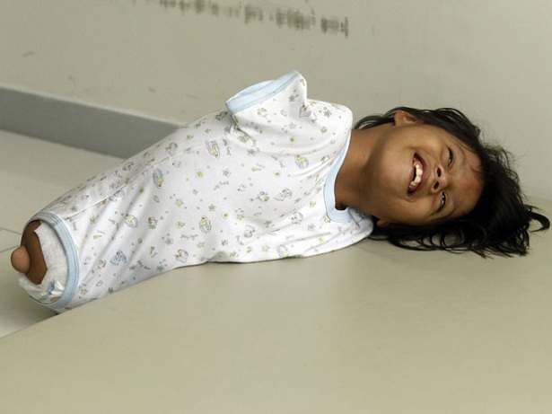 A menina sorri durante um dos exercícios da terapia (Foto: Reuters/Mariana Bazo)